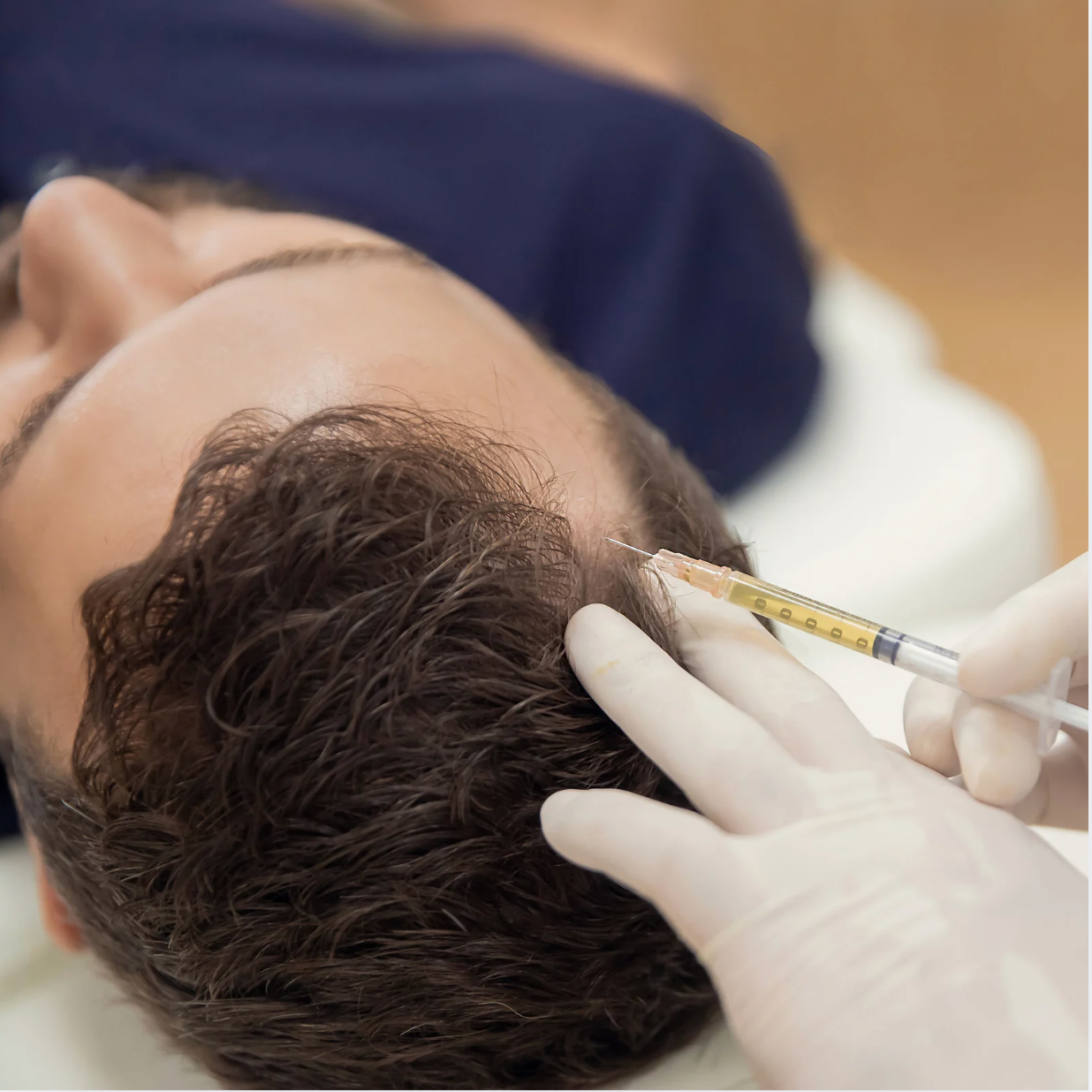 PRP Microneedling at Ultimate Solutions Medical Spa in Stamford, CT