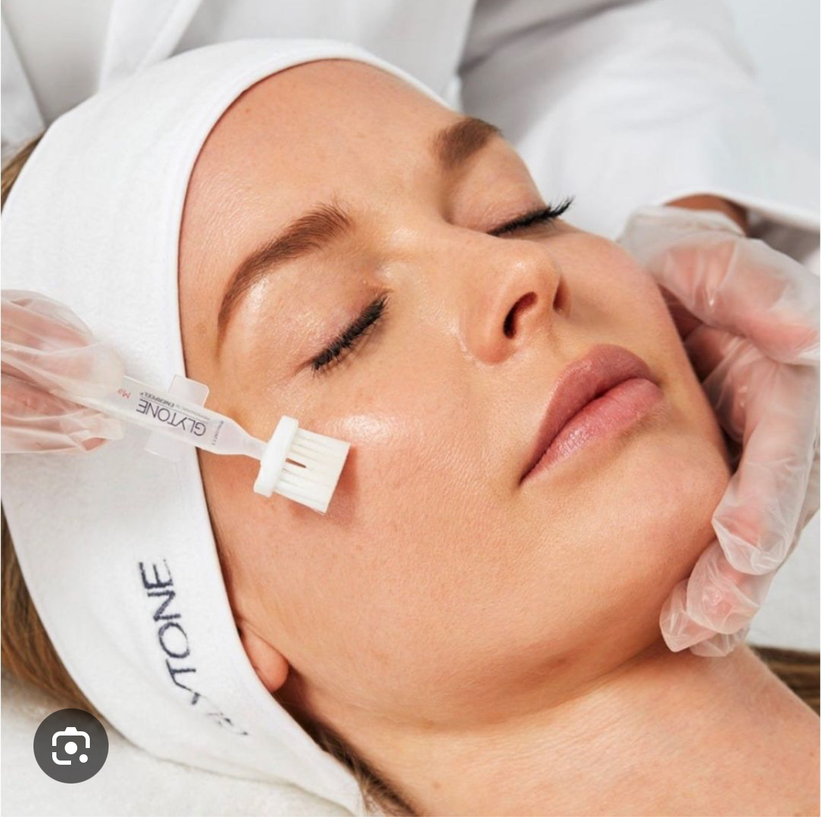 October Special-Glytone Peel at Le Reve in Fort worth, TX