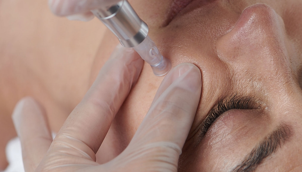 Microneedling Facial