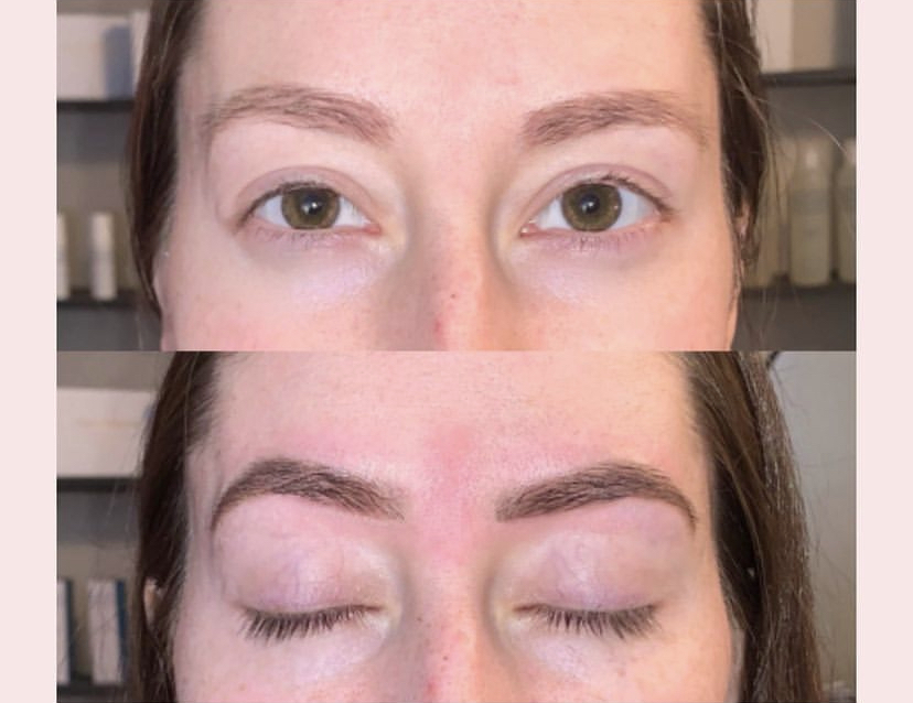 TrueBrow™ Natural TattooCorrection