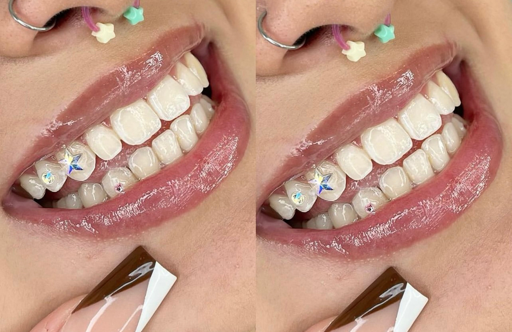 Gold Tooth Charm