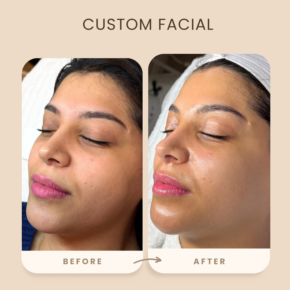 Custom Facial