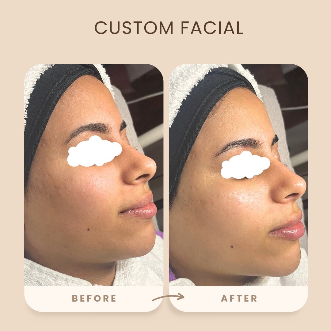 Custom Facial
