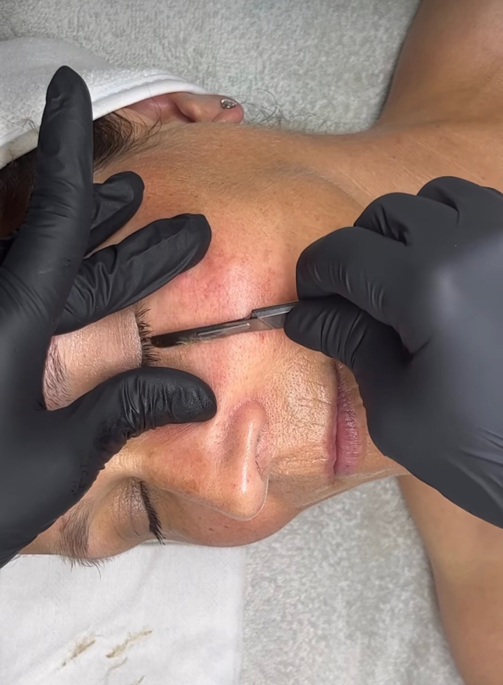 Dermaplaning Basic Facial