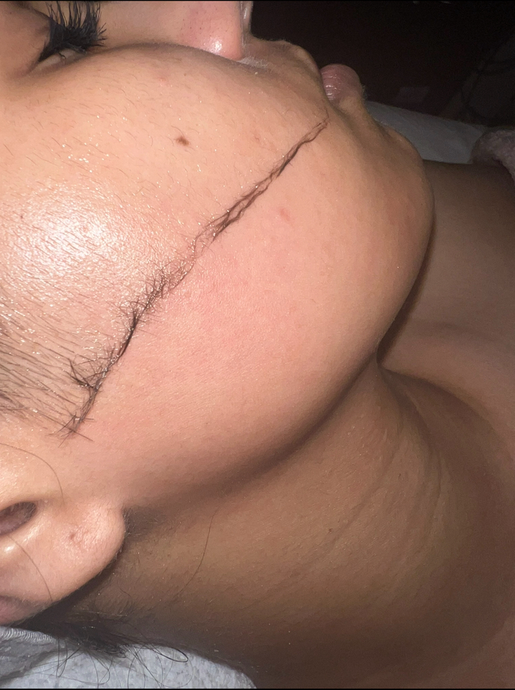 Dermaplaning Facial