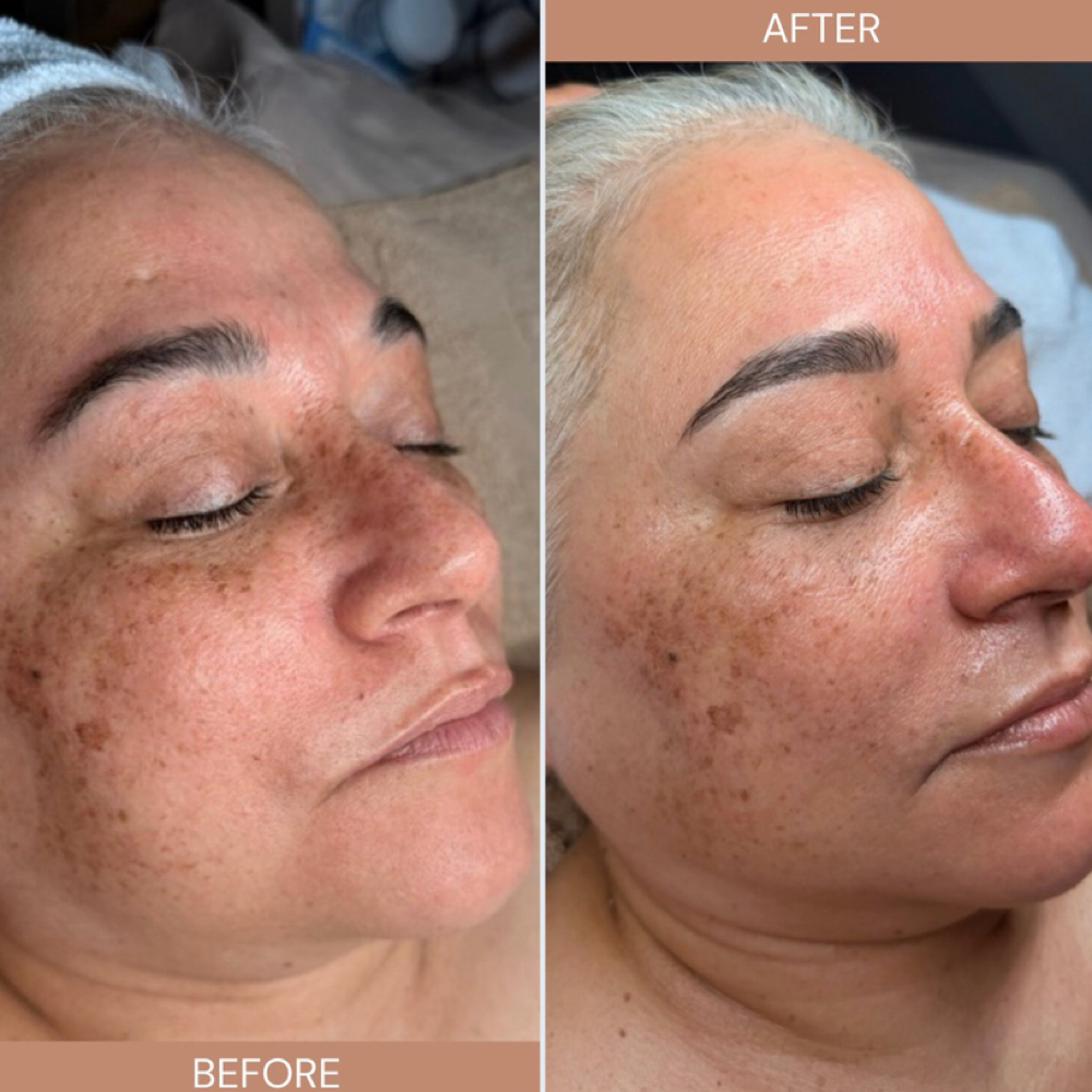 Areli’s Signiture Facial at Still Waters Esthetic Studio in Corpus Christi, TX
