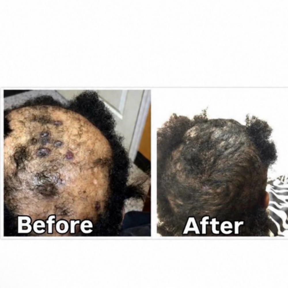 Microscopic Hair & Scalp Analysis at Divine Creations in Waldorf, MD