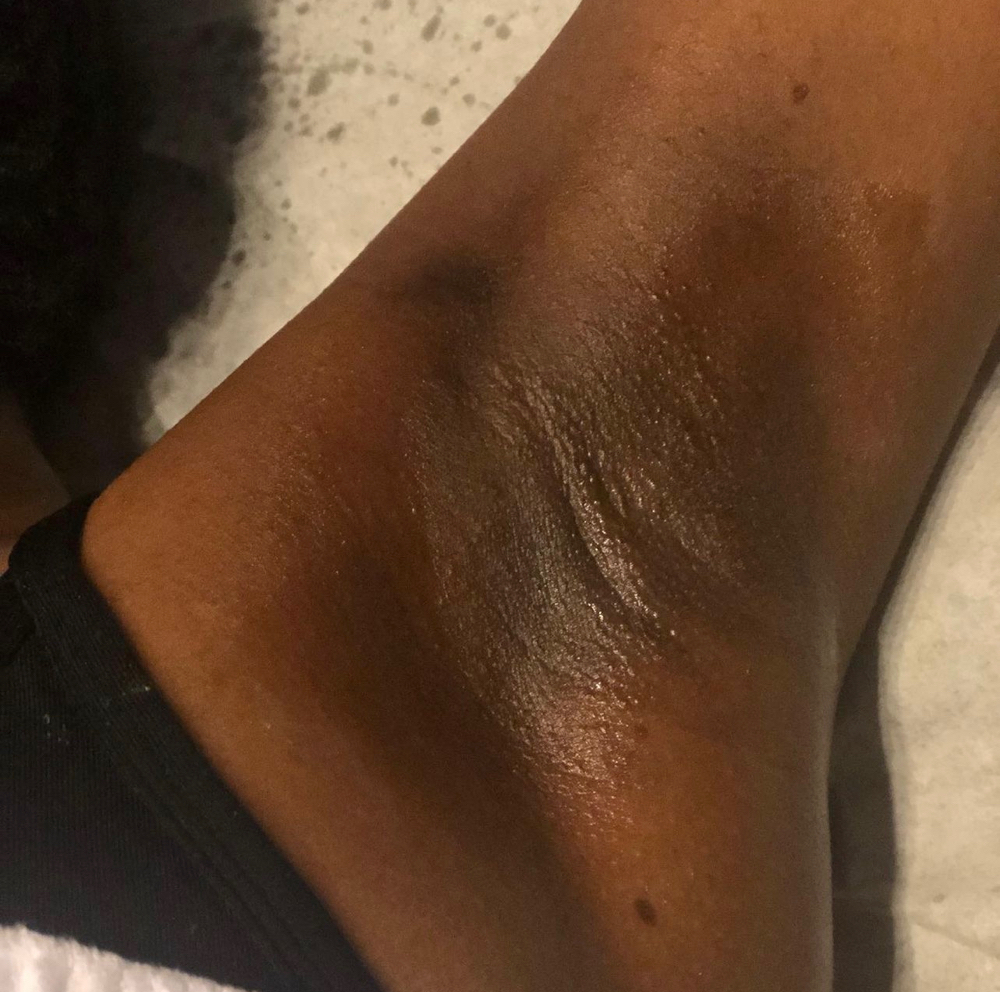 Teen Underarm Wax