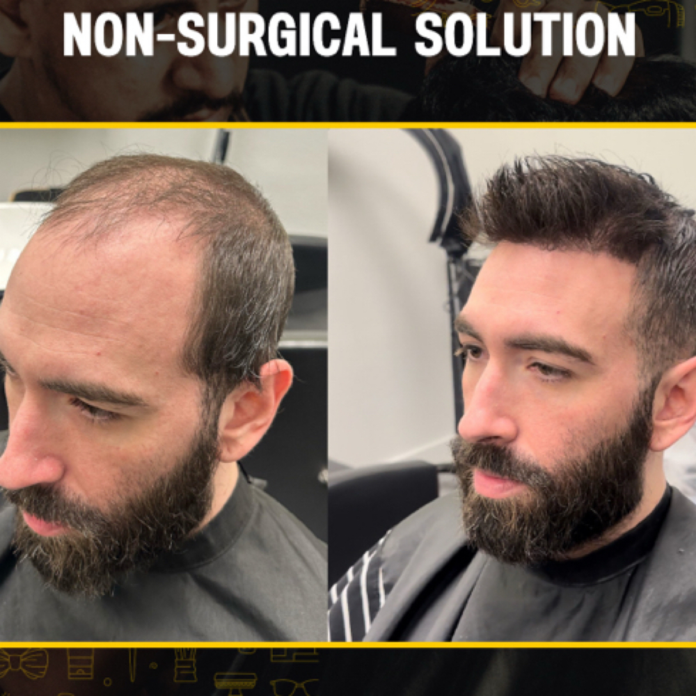 Hair System Consultation at TulipsFx Studio in Thousand Oaks, CA