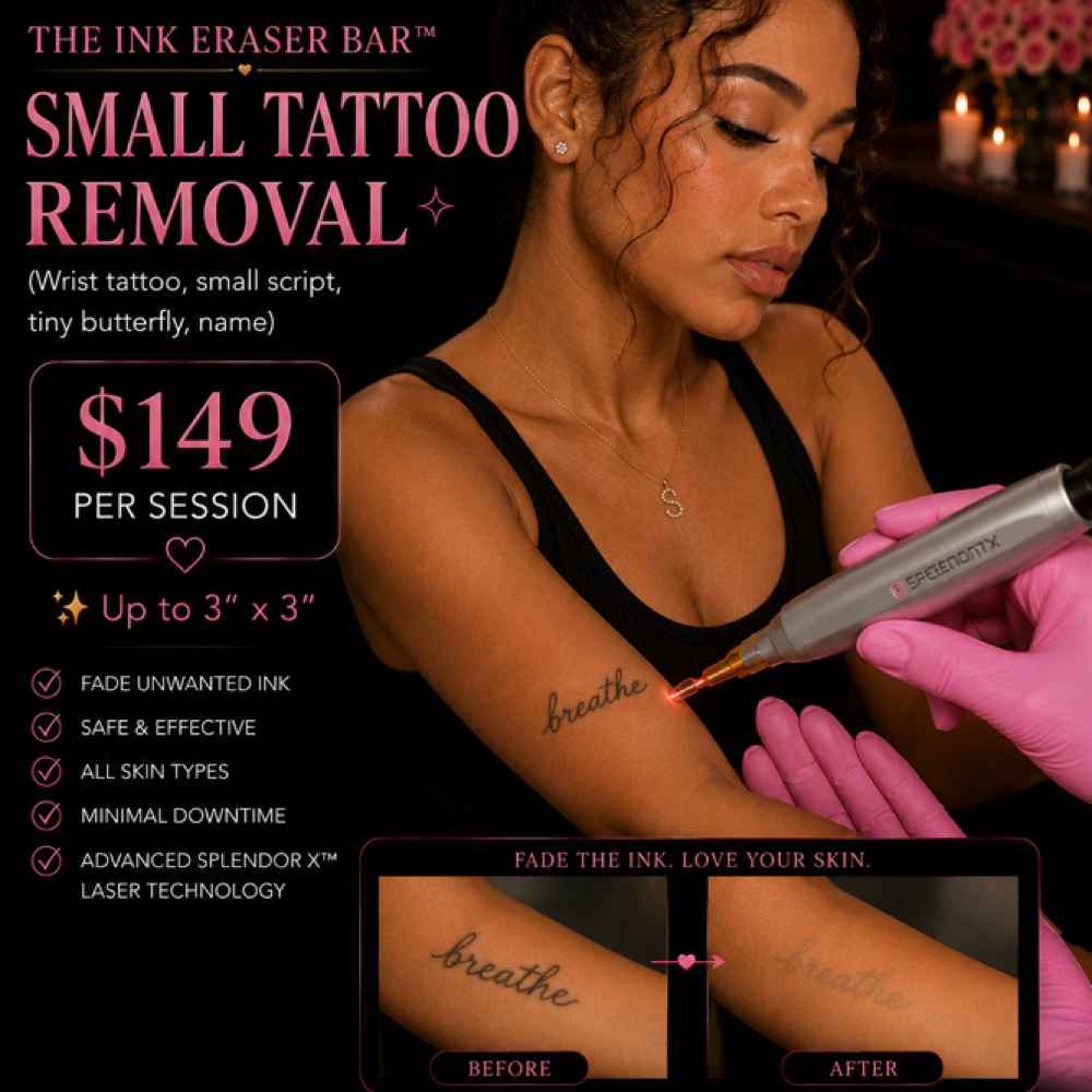 Small Tattoo Removal at Silk Society Beauty Bar in Houston, TX