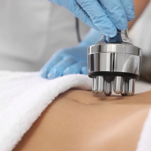 Radio Frequency Skin Tightening