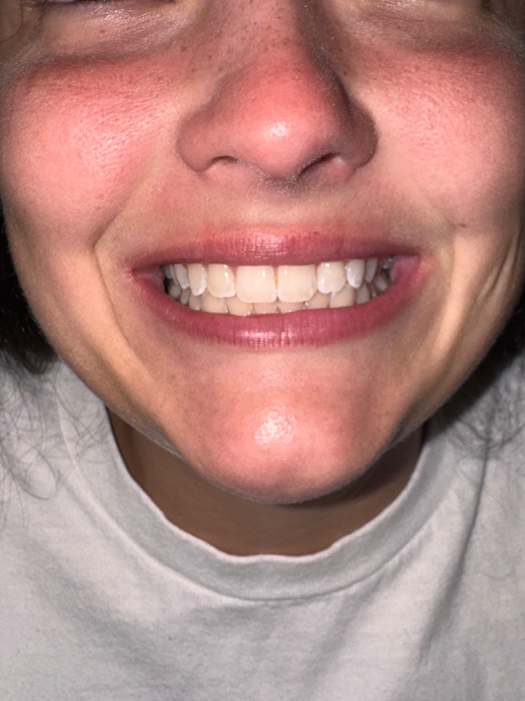 The Glow-Up Whitening Add On