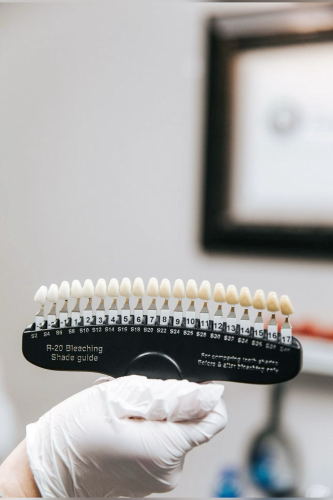 Teeth Whitening 60-80 Min Session