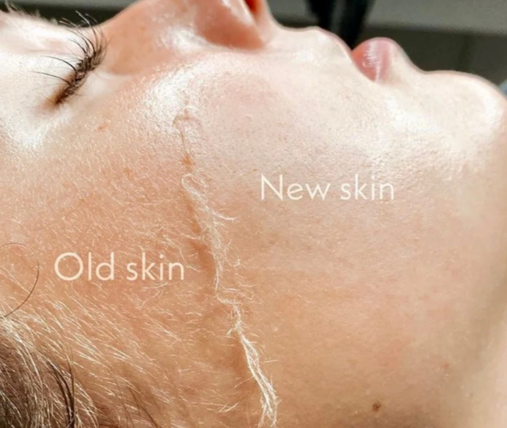 Dermaplan Glow