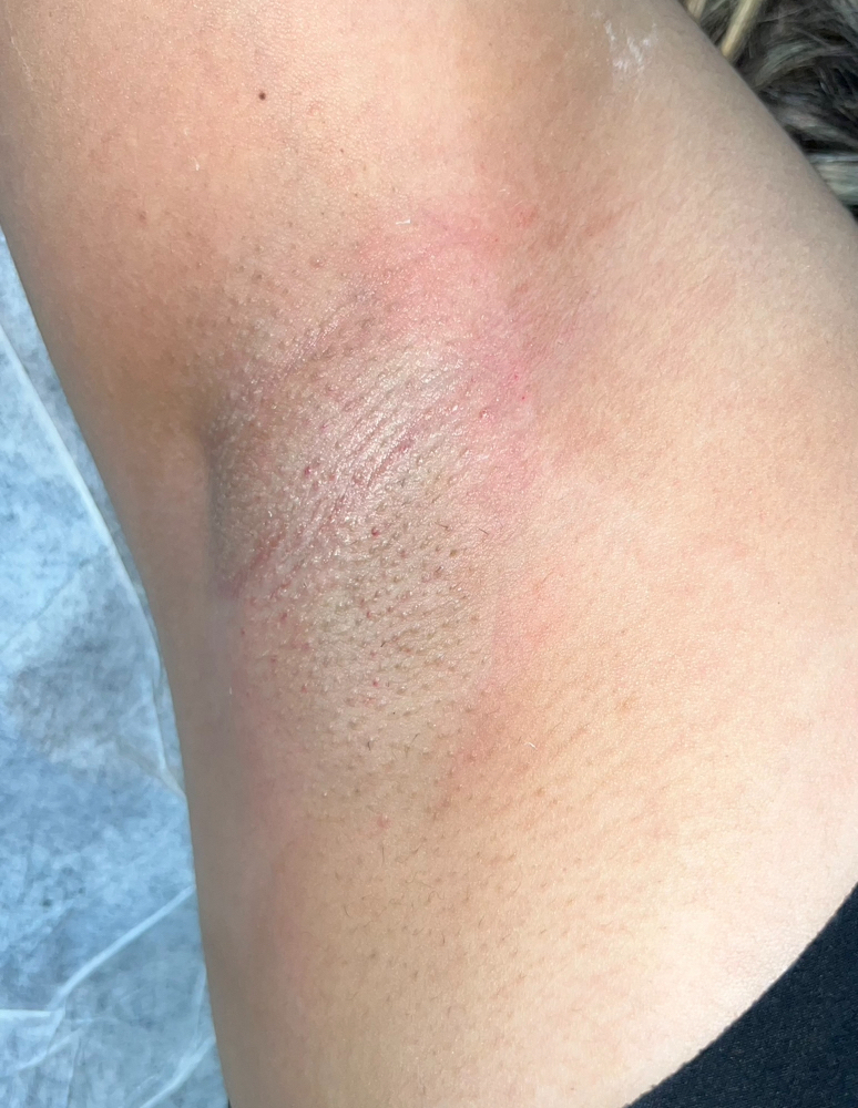 Underarm wax