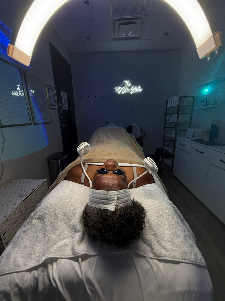 Custom Chemical Peel Session