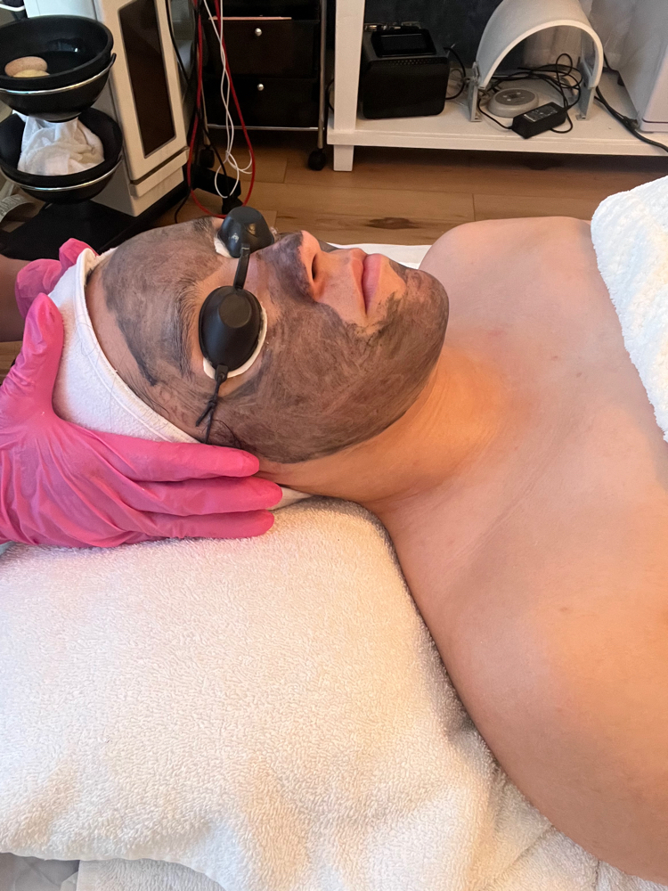 3 HOLLYWOOD PEEL &  Clean