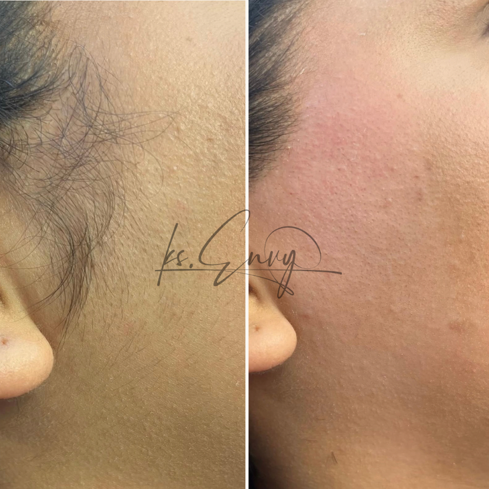 Face: Sideburns at KS.Envy in Columbus, OH