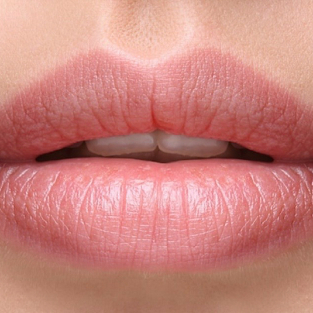 Lip Volumizer at Hiraya Medical Spa in Monroe Township, NJ
