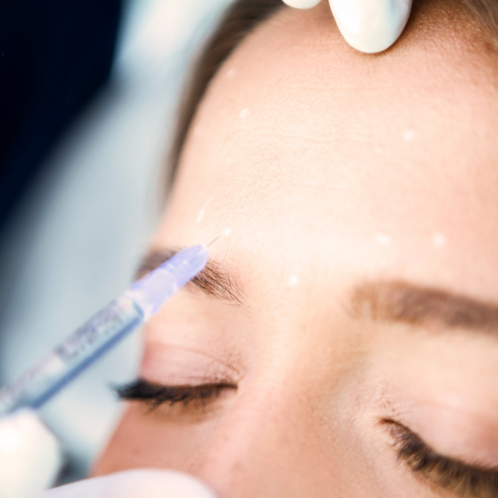 Botulinum Toxin