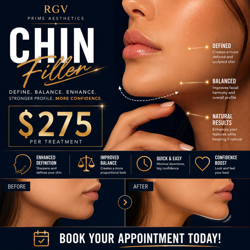 CHIN FILL at RGV PRIME AESTHETICS PLLC in Mcallen, TX