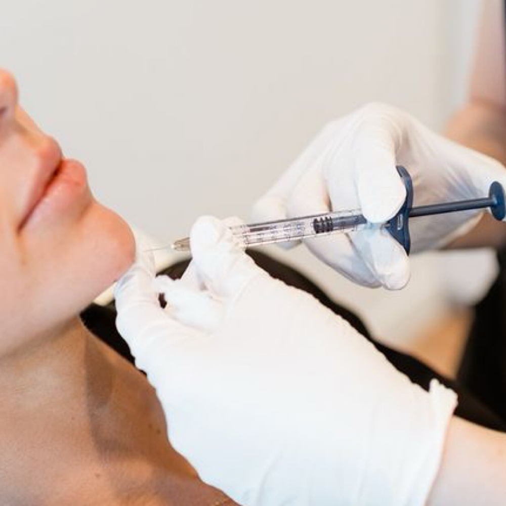 ✨ CHIN FILL at RGV PRIME AESTHETICS PLLC in Mcallen, TX