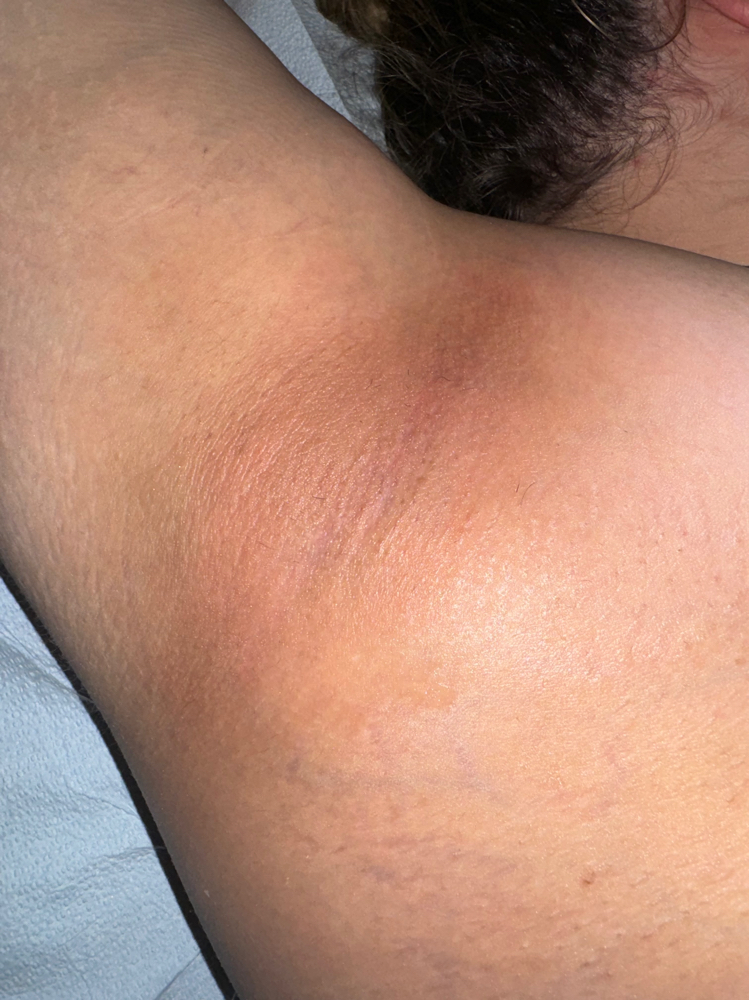 Underarm Wax