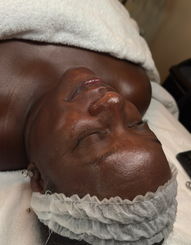Customized Facials (4 Weeks)