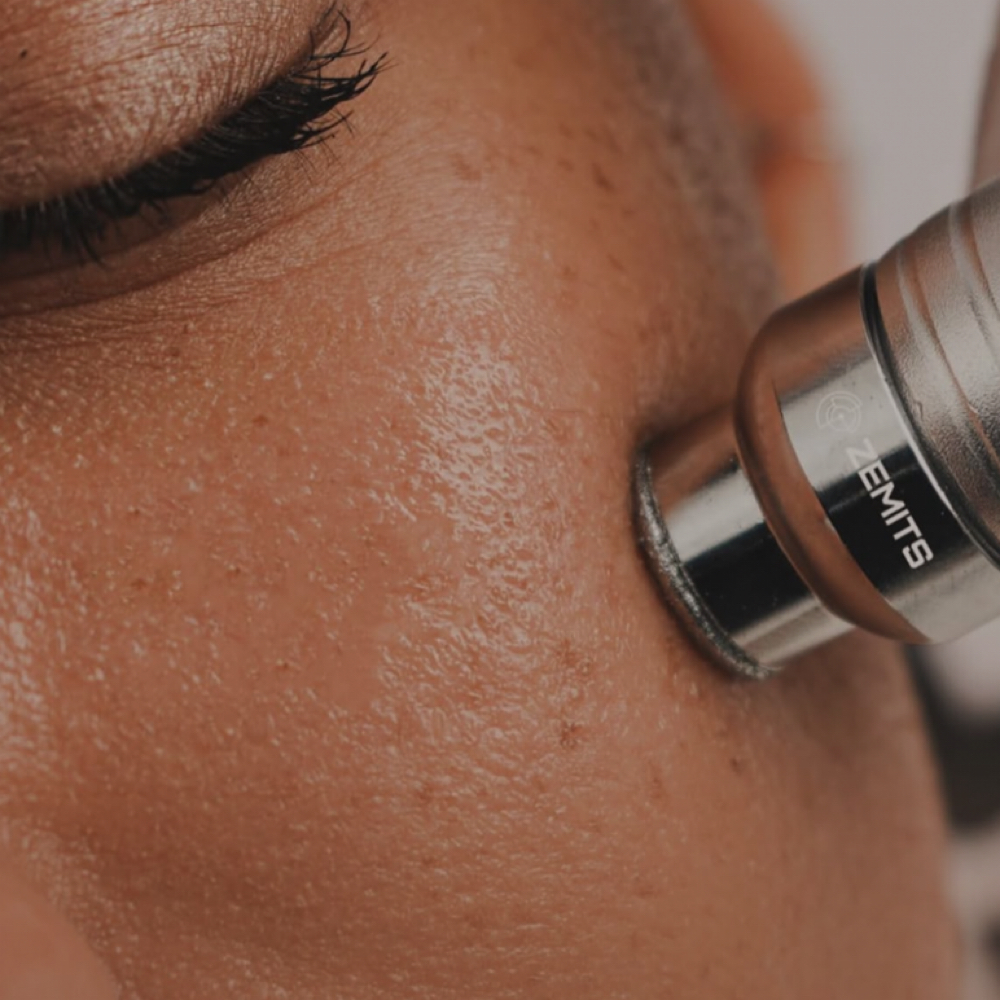 HydroDiamond Facial Treatment at The BOB Salon in Fort Wayne, IN