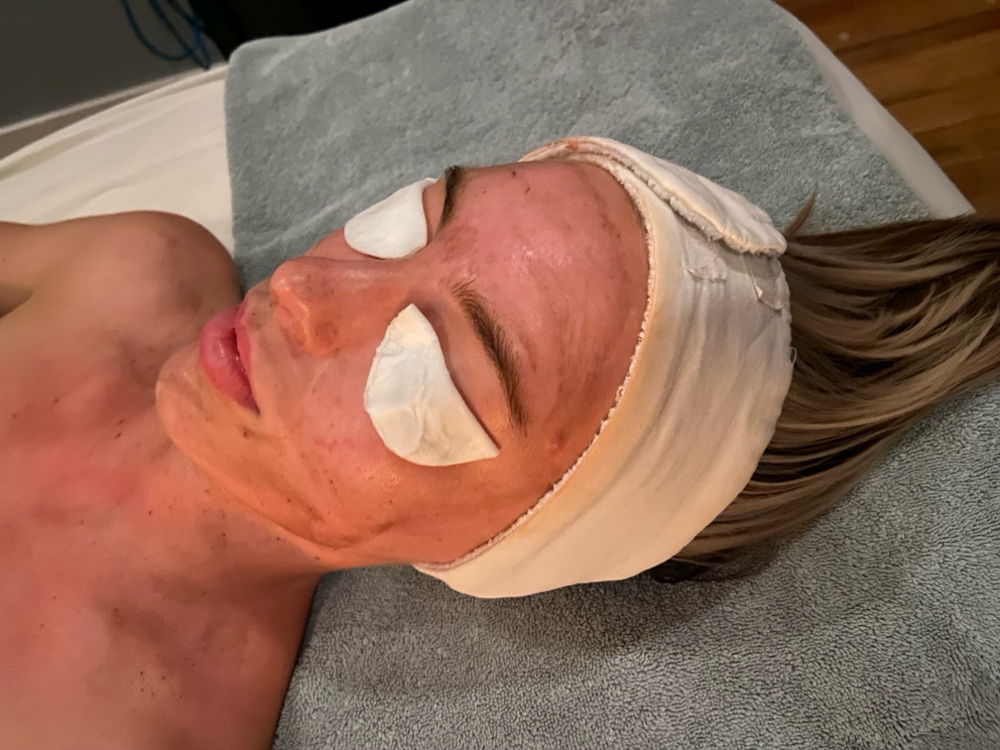 Skin Care Consult