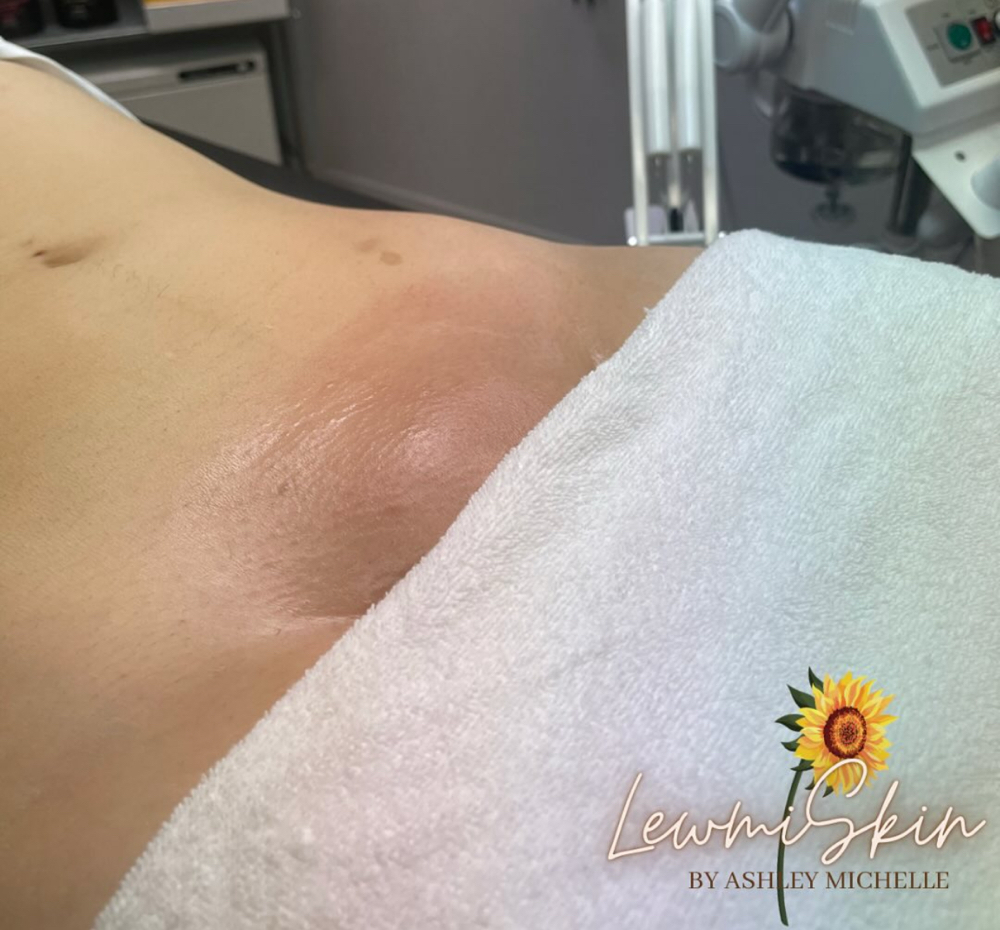 Bikini Wax