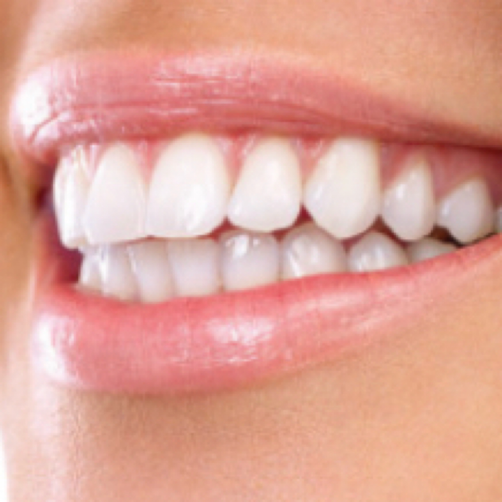 Whitening Wednesday at Allure Teeth Whitening in Greensboro, NC