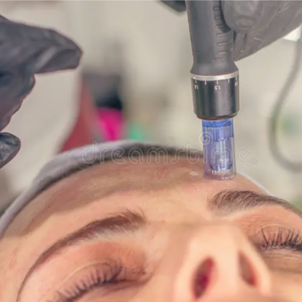 Microneedling at Fuzzy Peach in Boulder, CO