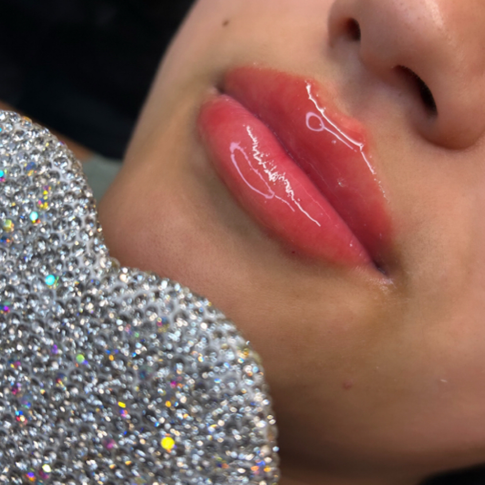 Lip Filler Course at AlamoAestheticsStudio in San Antonio, TX