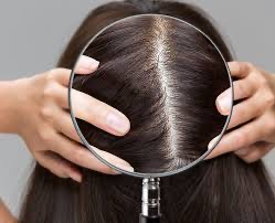 Scalp Analysis Consultation