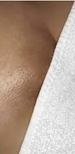 Brazilian Wax