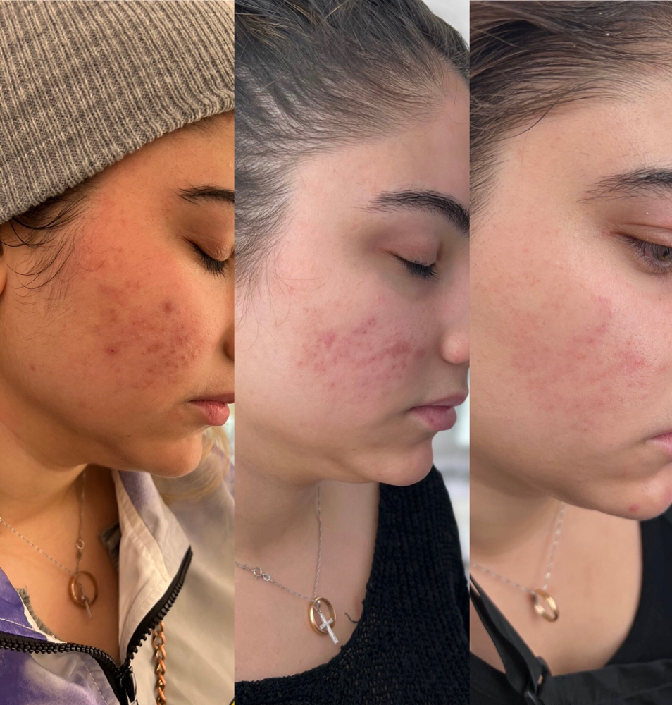 Immortal Clear Rescue at IMMORTALIZED BEAUTY BY ANGIE in Riverbank, CA