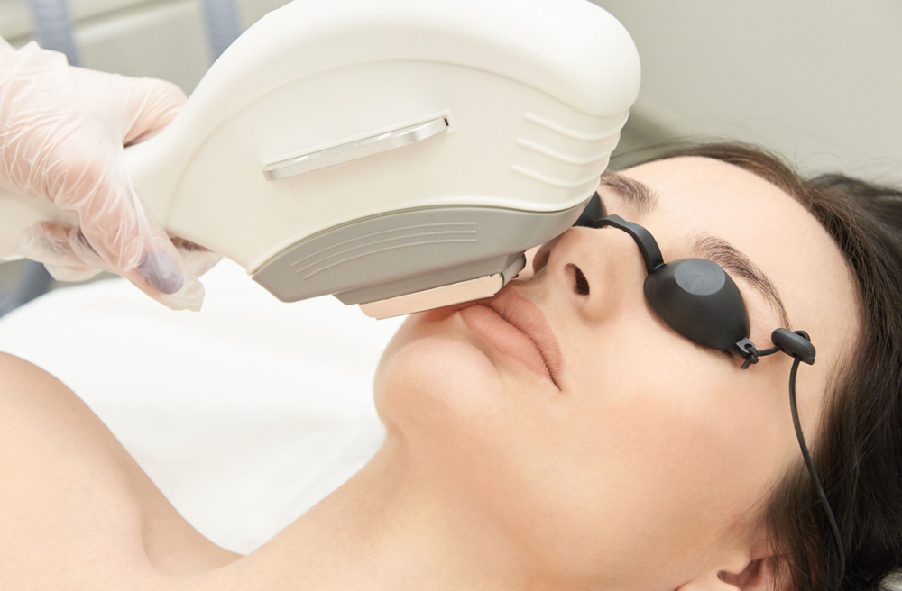 IPL Laser Facial