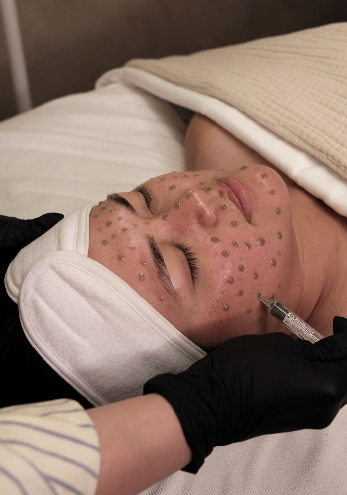 Marine Herbal Corrective Peel