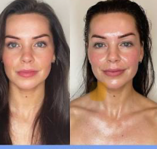 Lymphatic Drainage Facial