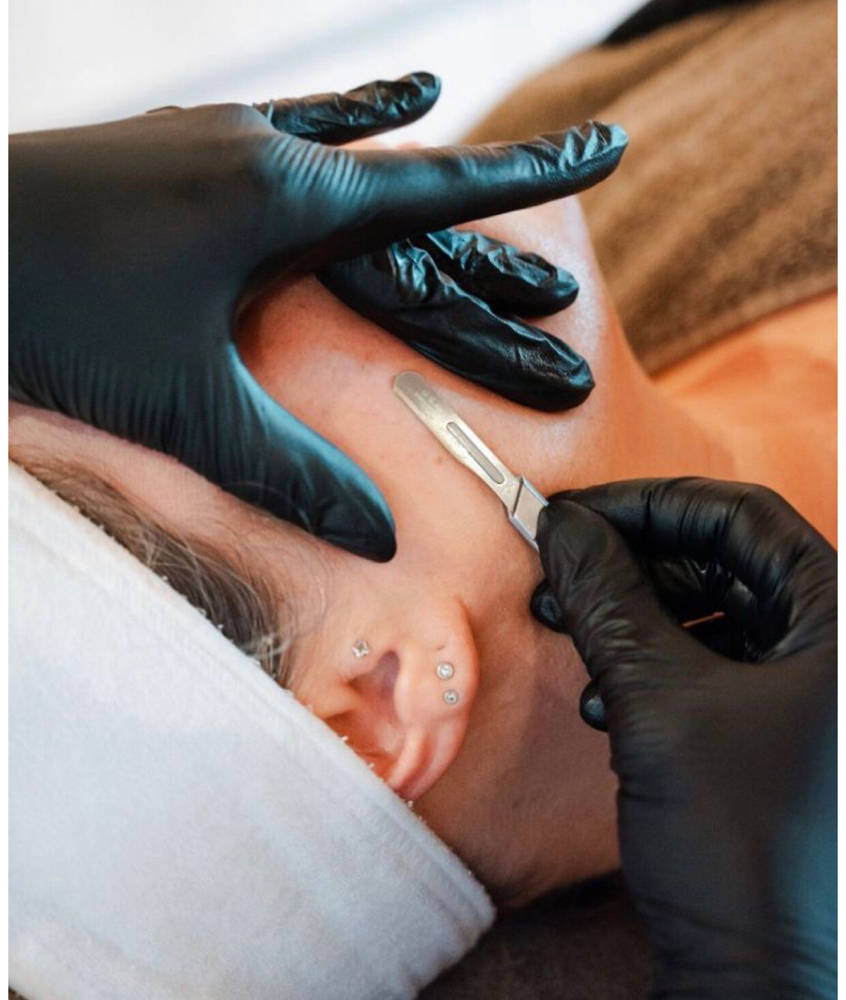 DERMAPLANE FACIAL