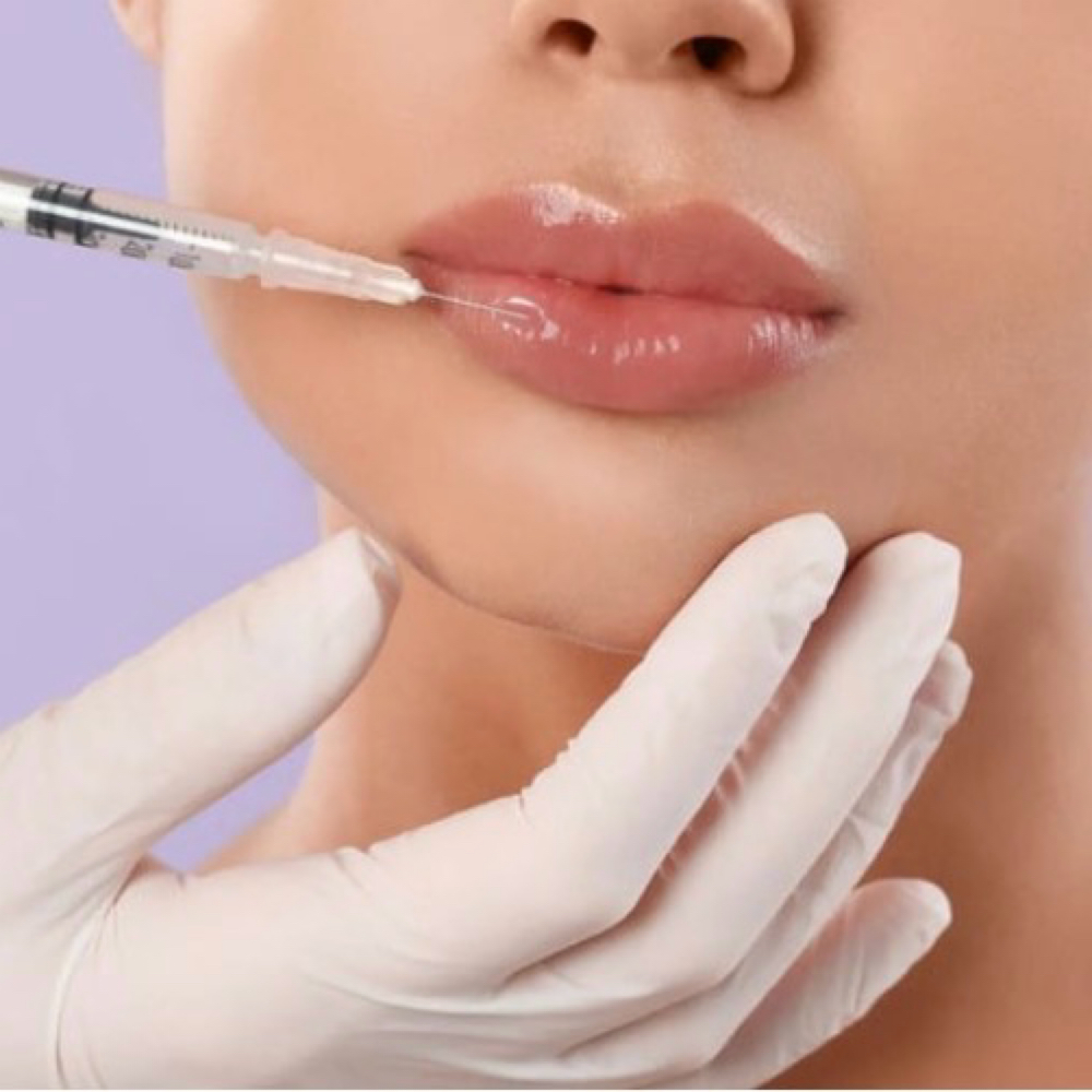 Filler Dissolve at Halie Jean aesthetics in Marlborough, MA