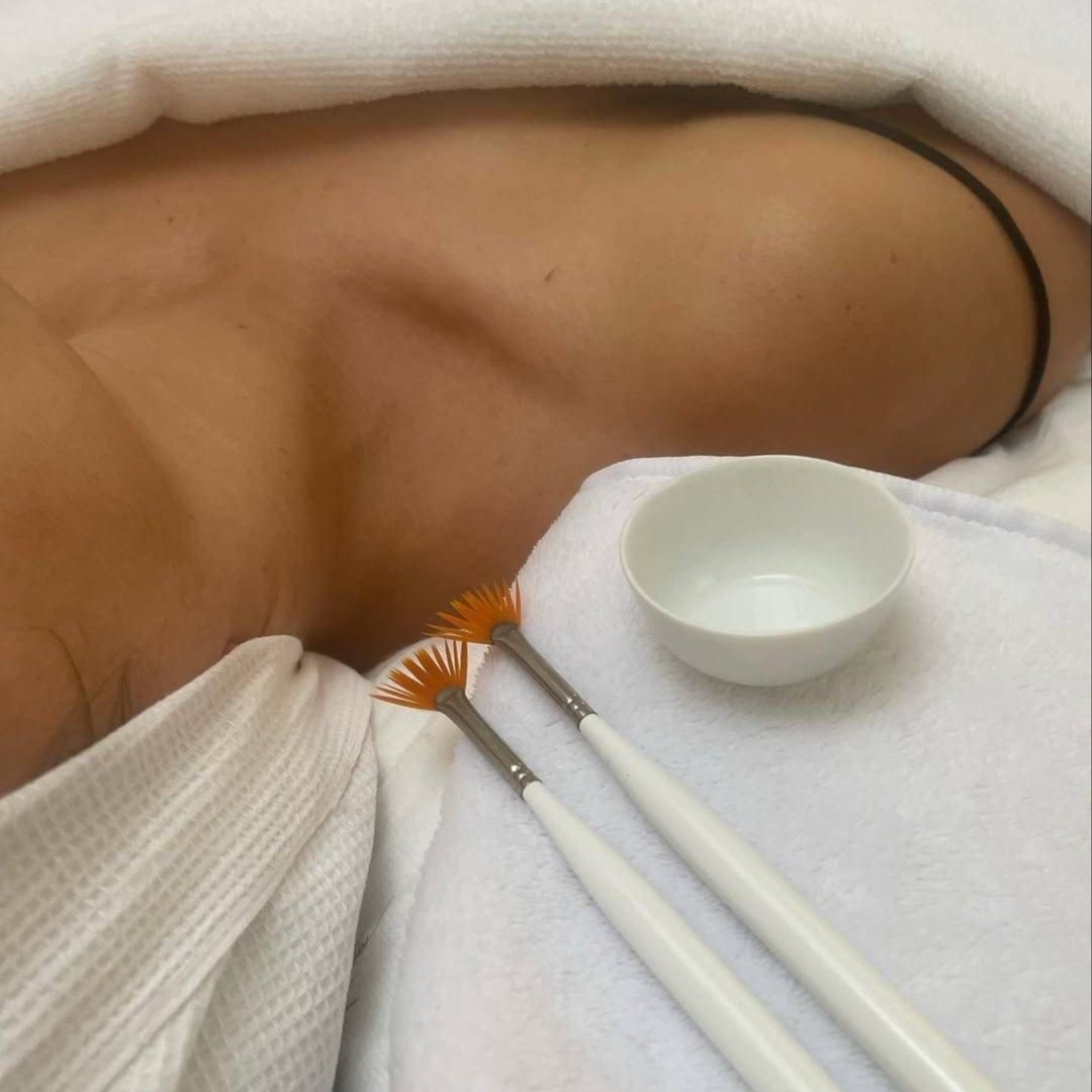 Chemical Peel at The Skin Sanctuary in Murfreesboro, TN