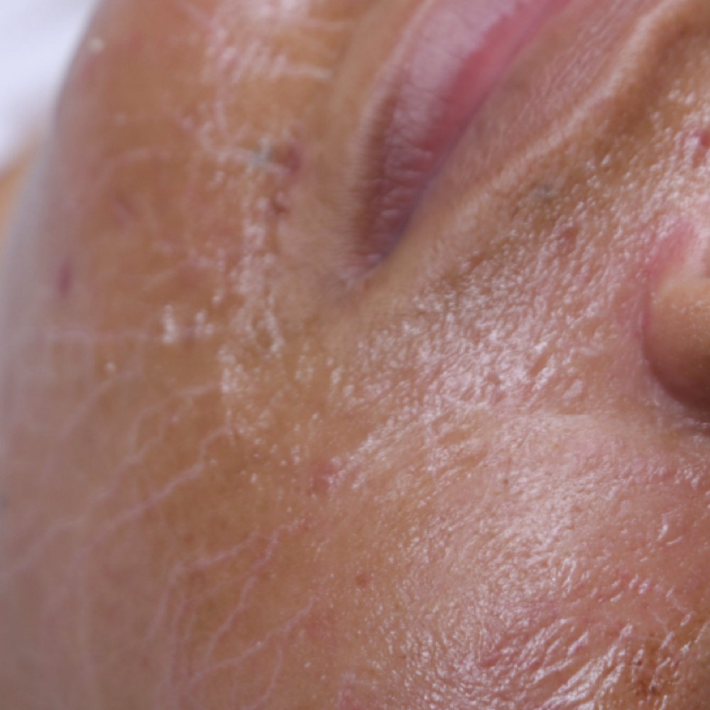 Ageless Facial at North Bama Esthetics in Albertville, AL