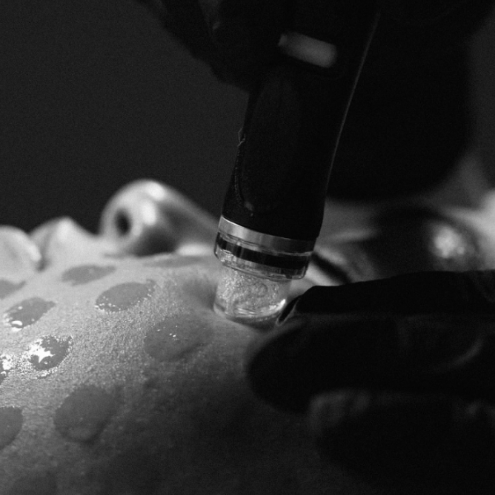 Hydro Facial at Ritual Esthetics in McDonough, GA