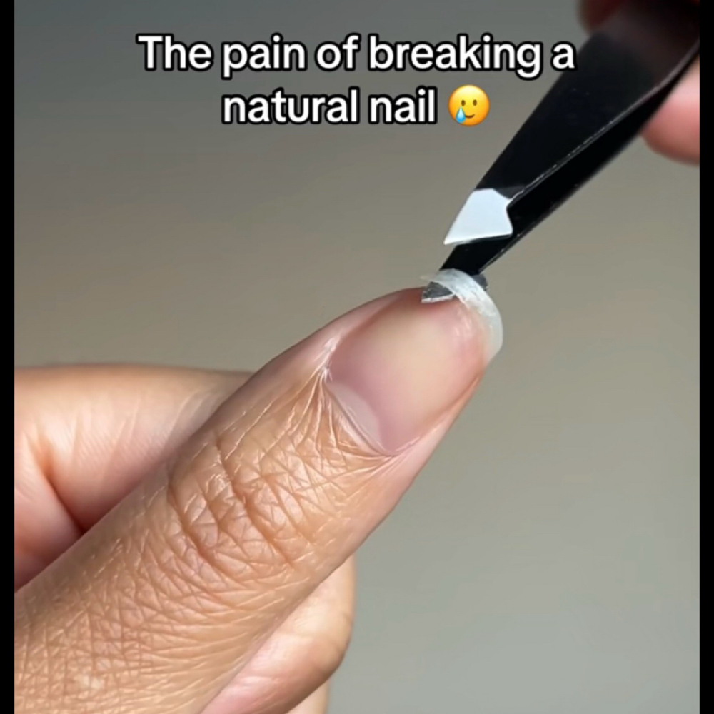 Fix A Nail at I Know Nails in Sarasota, FL