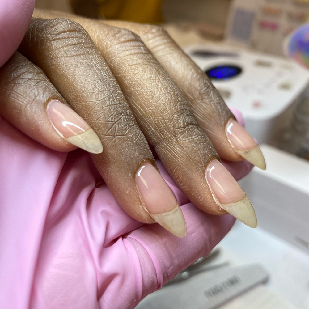 Gel Overlay / Fill
