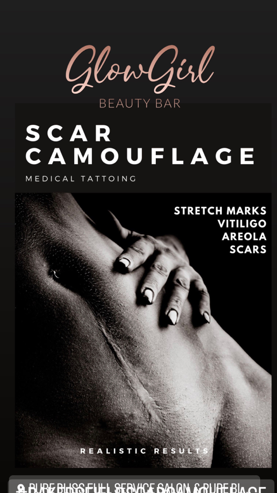 Scar Camoflauge