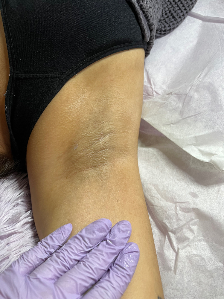 Underarm Wax