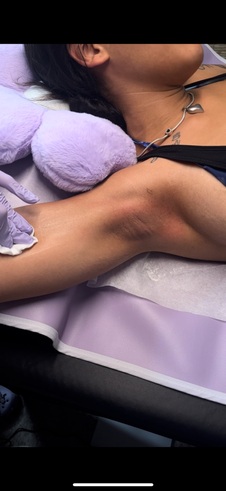 Underarm Wax at Desthetics Beauty in Bronx, NY